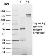 NEUROD2 (Neurogenic Differentiation 2) (Transcription Factor) Antibody in SDS-PAGE (SDS-PAGE)