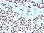 NFIA/NF1A (Nuclear Factor 1A) (Transcription Factor) Antibody in Immunohistochemistry (Paraffin) (IHC (P))