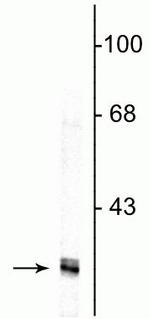 Fibrillarin Antibody in Western Blot (WB)