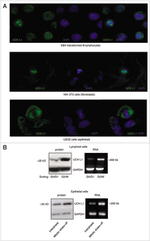 PGP9.5 Antibody in Western Blot (WB)