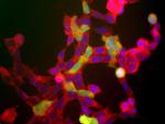 PGP9.5 Antibody in Immunocytochemistry (ICC/IF)