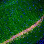 PGP9.5 Antibody in Immunohistochemistry (IHC)