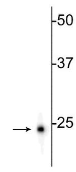 PGP9.5 Antibody in Western Blot (WB)