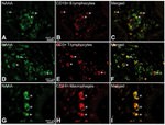 CD14 Antibody in Immunohistochemistry (IHC)