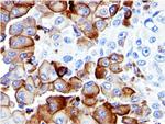 NGF-Receptor (p75)/CD271 (Soft Tissue Tumor Marker) Antibody in Immunohistochemistry (Paraffin) (IHC (P))