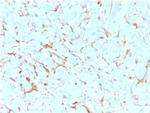 NGF-Receptor (p75)/CD271 (Soft Tissue Tumor Marker) Antibody in Immunohistochemistry (Paraffin) (IHC (P))