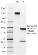 NGF-Receptor (p75)/CD271 (Soft Tissue Tumor Marker) Antibody in SDS-PAGE (SDS-PAGE)