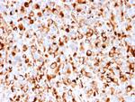 NGF-Receptor (p75)/CD271 Antibody in Immunohistochemistry (Paraffin) (IHC (P))