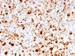 NGF-Receptor (p75)/CD271 Antibody in Immunohistochemistry (Paraffin) (IHC (P))