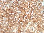 NGF-Receptor (p75)/CD271 (Soft Tissue Tumor Marker) Antibody in Immunohistochemistry (Paraffin) (IHC (P))