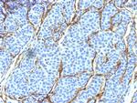 NGF-Receptor (p75)/CD271 (Soft Tissue Tumor Marker) Antibody in Immunohistochemistry (Paraffin) (IHC (P))