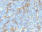 NGF-Receptor (p75)/CD271 (Soft Tissue Tumor Marker) Antibody in Immunohistochemistry (Paraffin) (IHC (P))