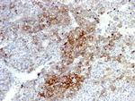 NGF-Receptor (p75)/CD271 (Soft Tissue Tumor Marker) Antibody in Immunohistochemistry (Paraffin) (IHC (P))