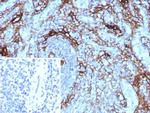 NGF-Receptor (p75)/CD271 (Soft Tissue Tumor Marker) Antibody in Immunohistochemistry (Paraffin) (IHC (P))