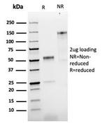 NGF-Receptor (p75)/CD271 Antibody in SDS-PAGE (SDS-PAGE)