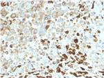 NGF-Receptor (p75)/CD271 Antibody in Immunohistochemistry (Paraffin) (IHC (P))