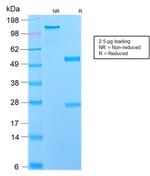 NGF-Receptor (p75)/CD271 Antibody in SDS-PAGE (SDS-PAGE)