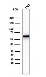 NGF-Receptor (p75)/CD271 Antibody in Western Blot (WB)