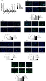 SOX2 Antibody in Immunocytochemistry (ICC/IF)