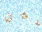 NKX2.2 (Neuroendocrine and Ewing's Sarcoma Marker) Antibody in Immunohistochemistry (Paraffin) (IHC (P))