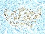 NKX2.2 (Neuroendocrine and Ewing'sarcoma Marker) Antibody in Immunohistochemistry (Paraffin) (IHC (P))