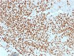 NKX2.2 (Neuroendocrine and Ewing's Sarcoma Marker) Antibody in Immunohistochemistry (Paraffin) (IHC (P))