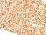 NKX2.2 (Neuroendocrine and Ewing's Sarcoma Marker) Antibody in Immunohistochemistry (Paraffin) (IHC (P))