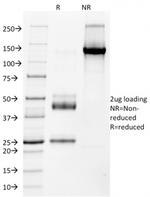 NKX2.2 (Neuroendocrine and Ewing's Sarcoma Marker) Antibody in SDS-PAGE (SDS-PAGE)