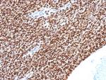 NKX2.2 (Neuroendocrine and Ewing's Sarcoma Marker) Antibody in Immunohistochemistry (Paraffin) (IHC (P))