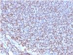 NKX2.2 Antibody in Immunohistochemistry (Paraffin) (IHC (P))