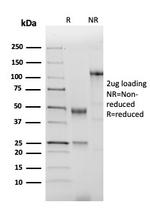 NKX2.2 Antibody in SDS-PAGE (SDS-PAGE)