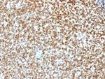 NKX2.2 (Neuroendocrine and Ewing's Sarcoma Marker) Antibody in Immunohistochemistry (Paraffin) (IHC (P))