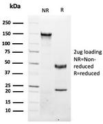 NKX3.1 Antibody in SDS-PAGE (SDS-PAGE)