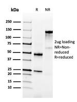 NKX3.1 Antibody in SDS-PAGE (SDS-PAGE)