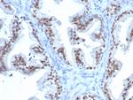 NKX3.1 (Metastatic Prostate Adenocarcinoma Marker) Antibody in Immunohistochemistry (Paraffin) (IHC (P))