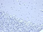 NKX3.1 (Metastatic Prostate Adenocarcinoma Marker) Antibody in Immunohistochemistry (Paraffin) (IHC (P))