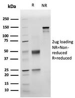 NKX3.1 (Metastatic Prostate Adenocarcinoma Marker) Antibody in SDS-PAGE (SDS-PAGE)