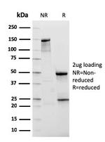 NKX3.1 Antibody in SDS-PAGE (SDS-PAGE)