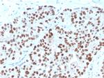 NKX3.1 (Metastatic Prostate Adenocarcinoma Marker) Antibody in Immunohistochemistry (Paraffin) (IHC (P))