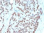 NKX3.1 (Metastatic Prostate Adenocarcinoma Marker) Antibody in Immunohistochemistry (Paraffin) (IHC (P))