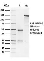 NME1/nm23-H1/NDPK-A (Suppressor of Metastasis) Antibody in SDS-PAGE (SDS-PAGE)