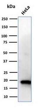 NME1/nm23-H1/NDPK-A (Suppressor of Metastasis) Antibody in Western Blot (WB)