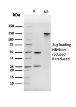 Nucleoside Diphosphate Kinase A/nm23-H1 Antibody in SDS-PAGE (SDS-PAGE)