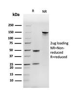 Nucleoside Diphosphate Kinase A/nm23-H1 Antibody in Immunoelectrophoresis (IE)