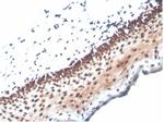 Nucleoside Diphosphate Kinase A/nm23-H1 Antibody in Immunohistochemistry (Paraffin) (IHC (P))