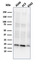 Nucleoside Diphosphate Kinase A/nm23-H1 Antibody in Western Blot (WB)