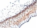 Nucleoside Diphosphate Kinase A/nm23-H1 Antibody in Immunohistochemistry (Paraffin) (IHC (P))