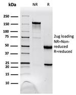 Nucleoside Diphosphate Kinase A/nm23-H1 Antibody in SDS-PAGE (SDS-PAGE)