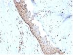 Nucleoside Diphosphate Kinase A/nm23-H1 Antibody in Immunohistochemistry (Paraffin) (IHC (P))