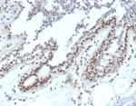 Nucleoside Diphosphate Kinase A/nm23-H1 Antibody in Immunohistochemistry (Paraffin) (IHC (P))